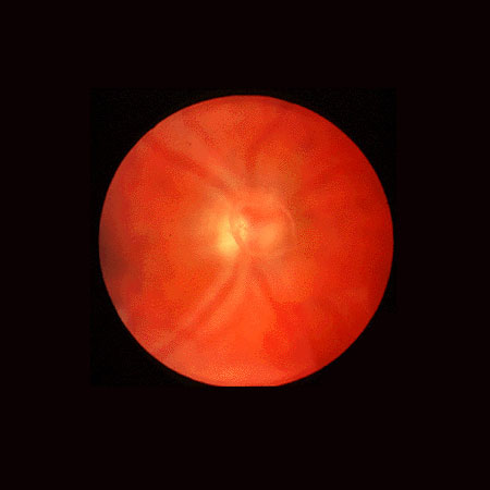 retina macula specialists of miami